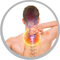 Thoát vị đĩa đệm cổ - Hình ảnh minh họa